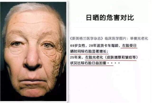 紫外线对皮肤的伤害.jpg